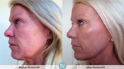 Nerium Results1