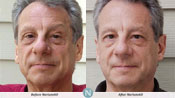 Nerium Results2