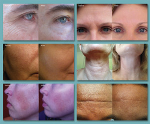 Nerium Results3